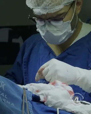 GIF do Dr. Pedro Henrique Lopes, ortopedista, realizando uma cirurgia no Hospital Santa Helena.
