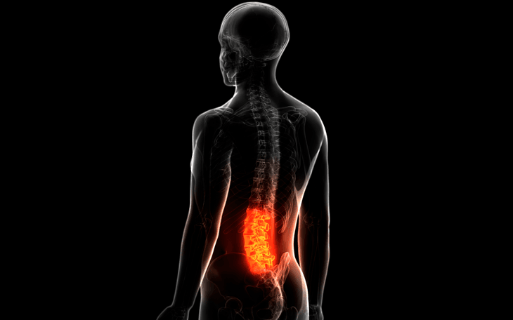 Representação em raio-x da lombalgia na coluna lombar, com ênfase no tratamento realizado pelo Dr. Pedro Henrique Lopes.