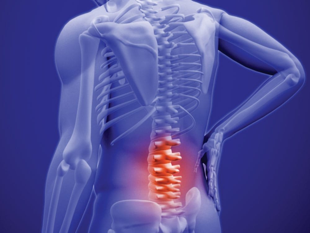 Representação gráfica da coluna lombar com destaque para lombalgia, elaborada para a página do Dr. Pedro Henrique Lopes.