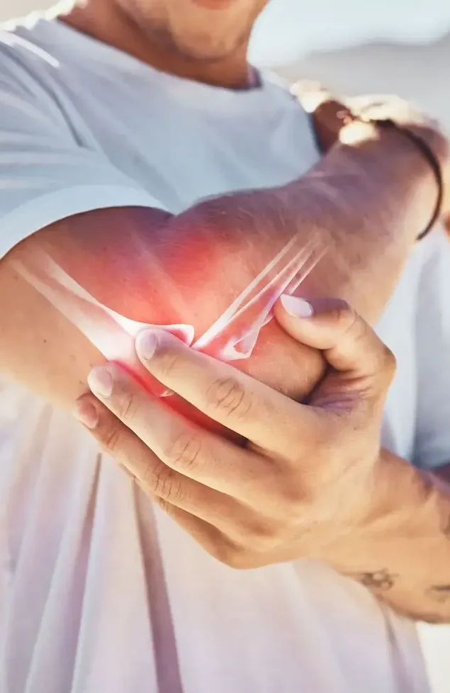 Homem segurando o cotovelo com inflamação visível devido à epicondilite, tratada pelo Dr. Pedro Henrique Lopes.