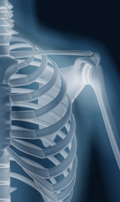 Realistic x-ray shots of human bones of skull pelvis thorax knee and limbs isolated vector illustration